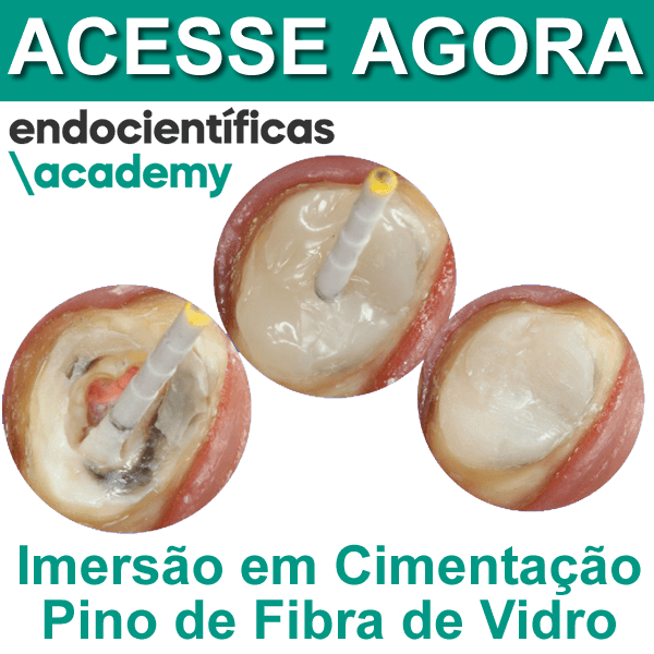Imersão em cimentação de pino de fibra de vidro Imersão em cimentação de pino de fibra de vidro